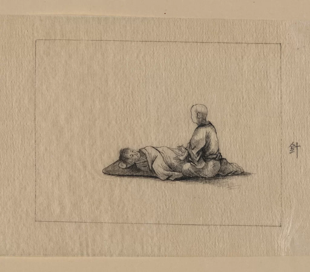 Traditional Monochrome Acupuncture Illustration Serene Cultural